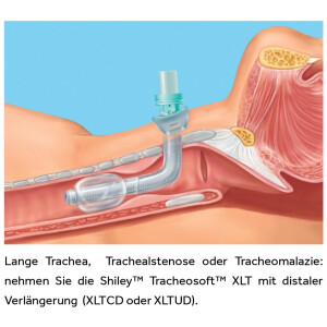 Shiley Tracheosoft XLTCD mit Cuff / distal verlängert - ab Größe 5