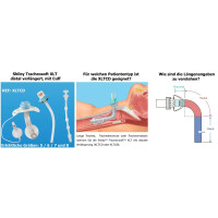 Shiley Tracheosoft XLTCD mit Cuff / distal verlängert - ab Größe 5