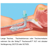 Shiley Tracheosoft XLTCD mit Cuff / distal verlängert - ab Größe 5