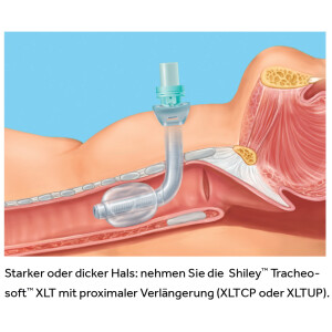 Shiley Tracheosoft XLTUP ohne Cuff / proximal verlängert, REF 60XLTUP - Größe 6