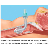 Shiley Tracheosoft XLTUP ohne Cuff / proximal verlängert, REF 80XLTUP - Größe 8